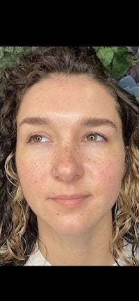 a woman with freckles on her face