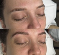 a woman's eyebrows before and after treatment